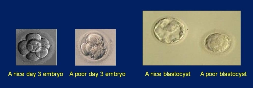 Embryos1